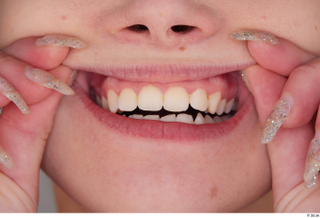 Olivia Sparkle teeth 0002.jpg